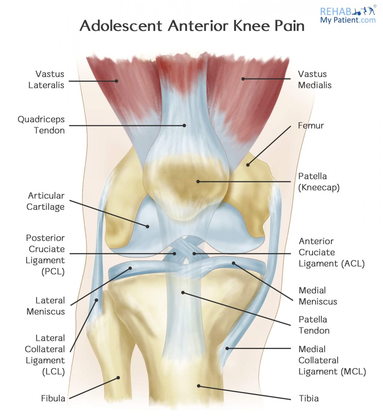 Adolescent Anterior Knee Pain